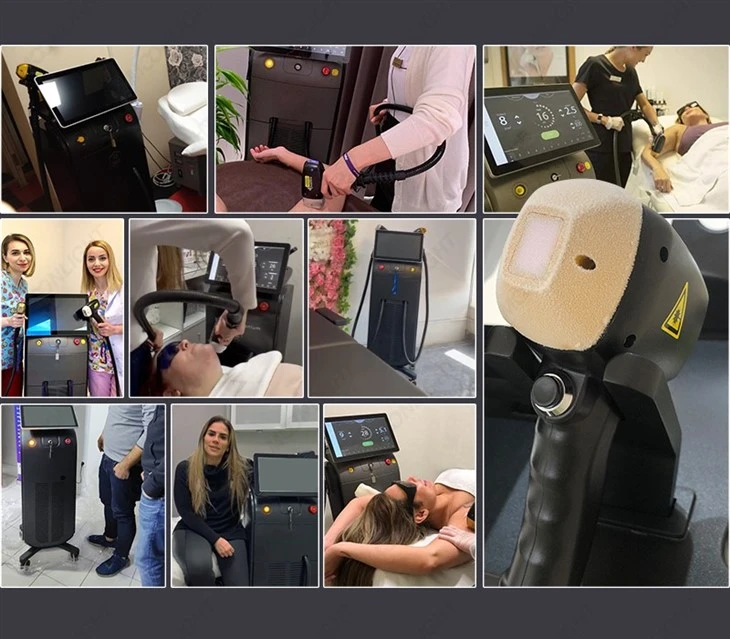 Diode Laser Hair Removal Machineprice